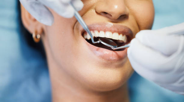 Ultimate Guide to Oral Health for Belconnen Residents