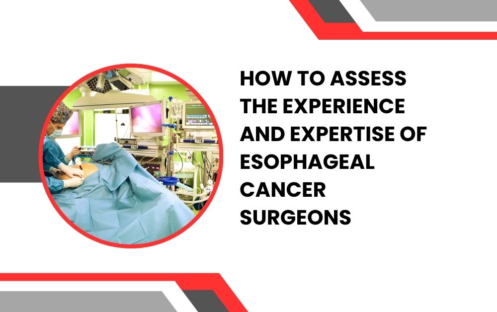 esophageal cancer surgeons in Dubai