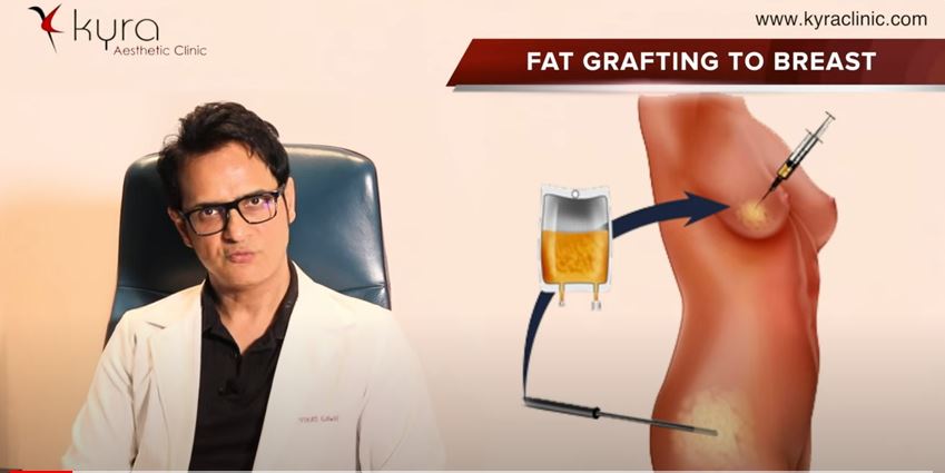 cost of fat transfer to breast in ludhiana